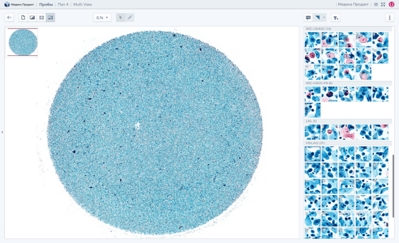 Продукт Vision Suite картинка 2 Скриншот Vision Suite картинка 2