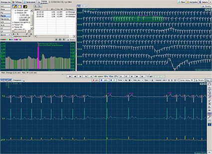 Продукт МИОКАРД-ХОЛТЕР-2 картинка 1 Скриншот МИОКАРД-ХОЛТЕР-2 картинка 1