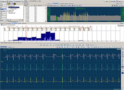 Продукт МИОКАРД-ХОЛТЕР-2 картинка 2 Скриншот МИОКАРД-ХОЛТЕР-2 картинка 2